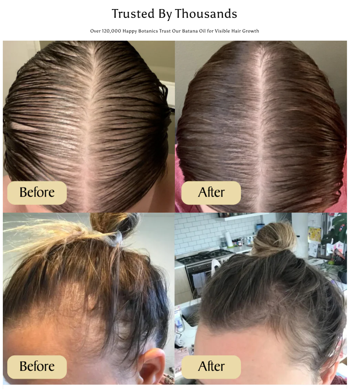 RegenHair Growth Serum Spray